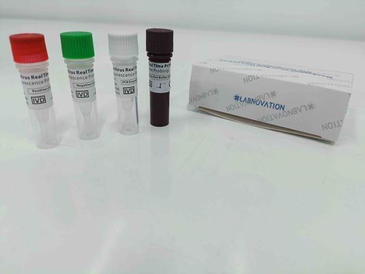 chất lượng  Real Time Monkeypox PCR Test Kit With Positive / Negative Control nhà máy sản xuất
