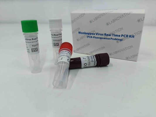 Bộ xét nghiệm nhanh PCR virus đậu mùa Thời gian thực cho các mẫu dịch tiết thương tổn huyết thanh người